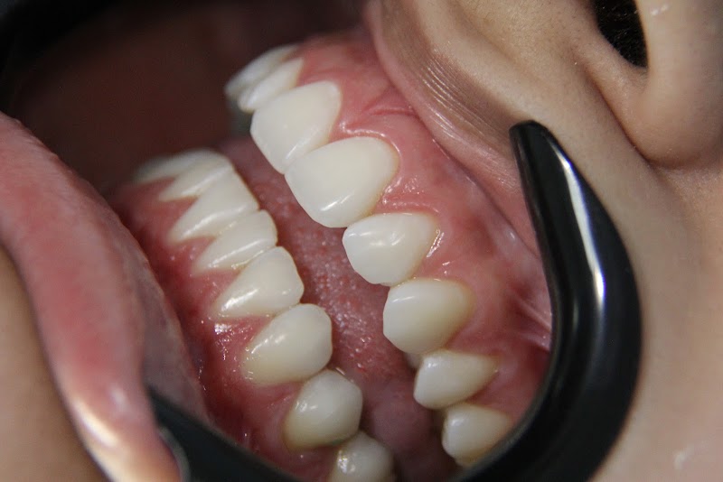 Foto de Dr. Felipe Azevedo, Dentista Clínico Geral em Cabo Frio