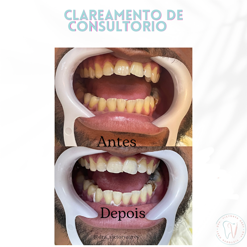 Foto de Doutora Victorya Grey Simas, Dentista Clínica Geral em Arraial do Cabo