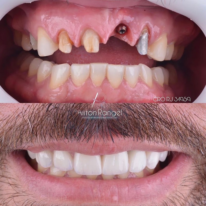 Foto de OdontoLife, Clínica de Implantodontia em Cabo Frio