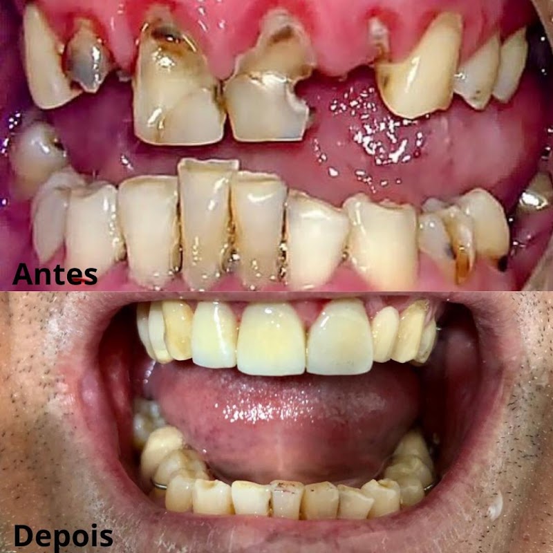 Foto de Odontocli, Clínica de Prótese Dentária em Cabo Frio