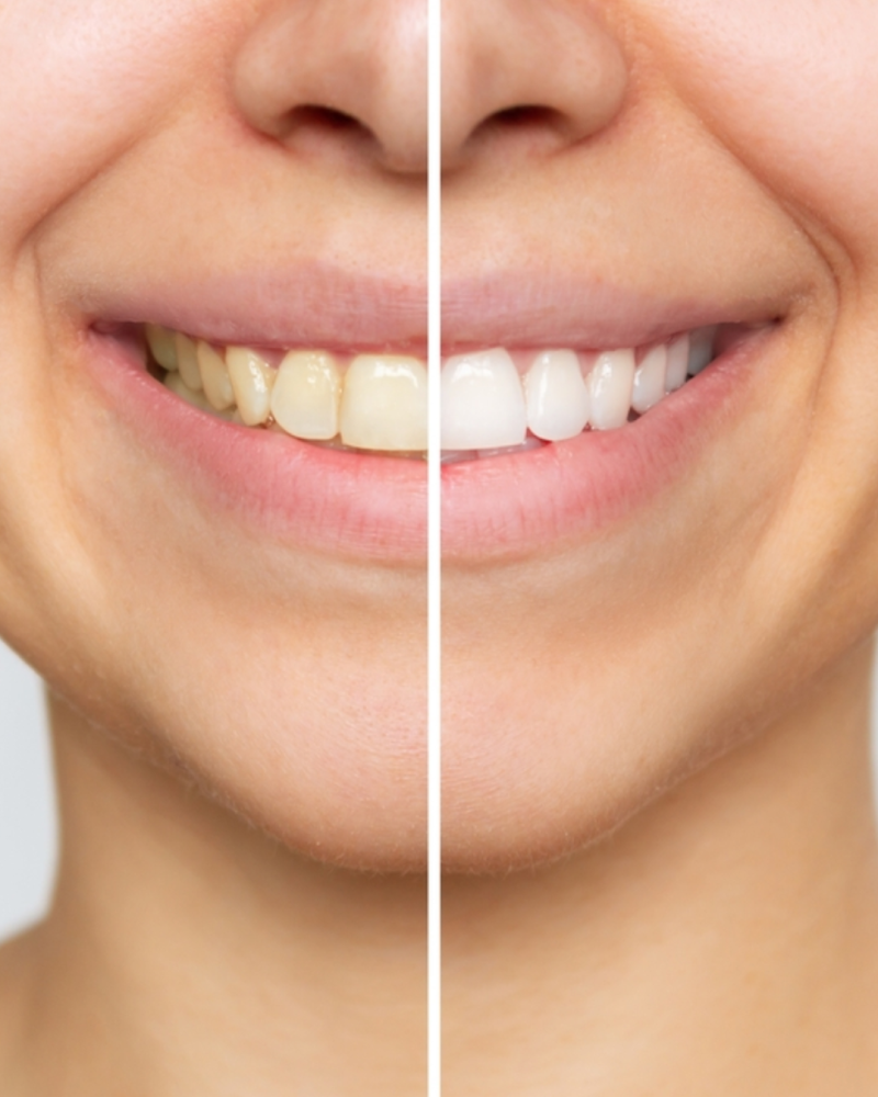Foto de Miarelli Laurente Odontologia, Clínica de Odontologia Estética em Cabo Frio